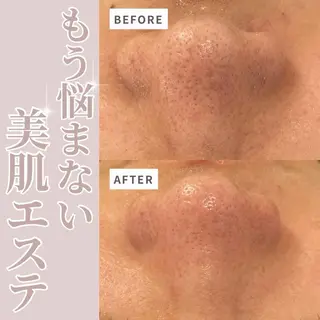 💚THE BALM 金子💚✨のエステ・リラクイメージ