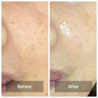 bonuru salonのエステ・リラクイメージ