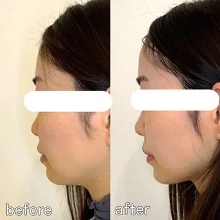 小顔矯正&美容整体 整え屋REDオーナーのエステ・リラクイメージ