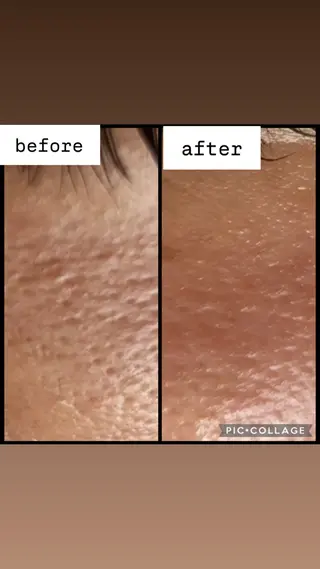 Bright所属・Brightブライト (エステ.リラク)のエステ・リラクイメージ