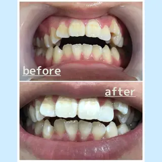 メンズ お手軽ホワイトニングsalon mina所属・武元 奈津美のその他イメージ