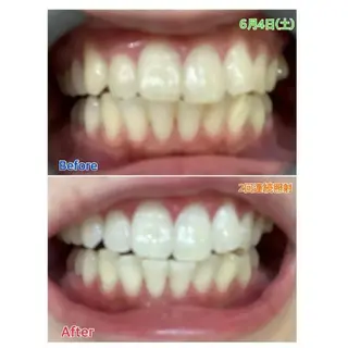 M渋谷店所属・M渋谷 ホワイトニングのその他イメージ