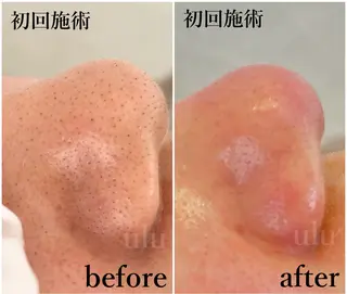 ulu 眉毛ハーブ毛穴肌改善の眉毛・アイブロウイメージ