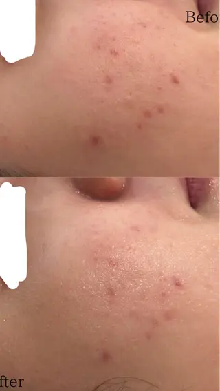 デ・アイム塚口所属・肌質/体質改善 久下玲菜のエステ・リラクイメージ