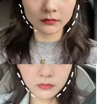 ネイル aliaハイフ&水光ジェットサロン所属・aliaハーブ水光店 エステティシャン募集のエステ・リラクイメージ