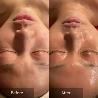 Mandarin Orange所属・毛穴から始める肌メン テマンダリンオレンジのエステ・リラクイメージ