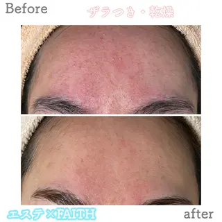 ショート パーマ ヘアアレンジ メンズ キッズ ネイル マツエク・マツパ アイブロウ ニキビ&跡改善サロン オーナー光木のエステ・リラクイメージ