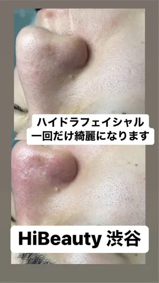 Hi Beauty 渋谷(ネイル、ハイパーナイフ6、脂肪れいきゃく、マッサージ&エステサロン)所属・Hi beauty 渋谷のネイルデザイン