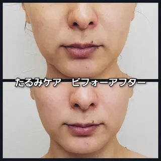 シミ・たるみ専門 サロン Cherieのエステ・リラクイメージ