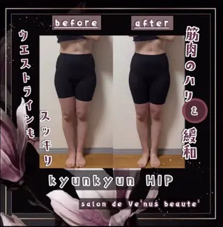 ヴィーナス ビューティーのエステ・リラクイメージ