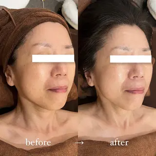 NOEL所属・フェイシャルエステ Utaiのエステ・リラクイメージ