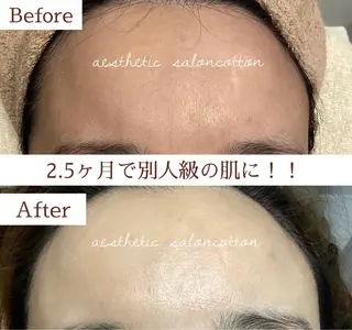 都度払い 肌質改善専門サロンのエステ・リラクイメージ