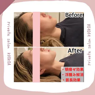中目黒  整体 小顔 KUOKOAのエステ・リラクイメージ