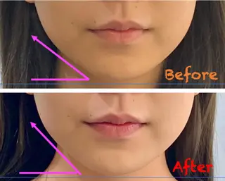 小顔美肌&痩身ｻﾛﾝ My Timeのエステ・リラクイメージ