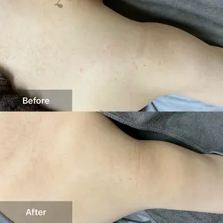 ハーブピーリング 専門店MOKA所属・ハーブピーリング専門 MOKAのエステ・リラクイメージ