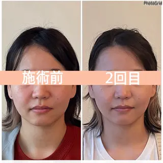 小顔矯正サロン　ReFace Fusae（リフェイスフサエ）所属・小顔矯正サロン リフェイスフサエのエステ・リラクイメージ