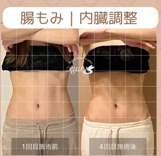 【頭痛、睡眠改善】 salon RUUのエステ・リラクイメージ