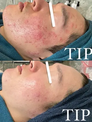 パーソナル肌質改善 🦋APRI🅿️有のエステ・リラクイメージ