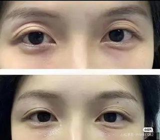 aliaハイフ&水光ジェットサロン所属・aliaハーブ水光店 エステティシャン募集のエステ・リラクイメージ