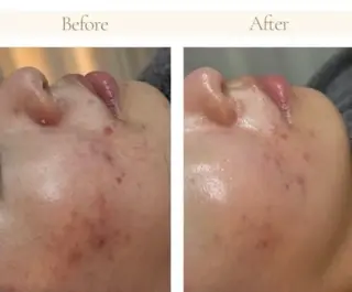 井上 裕子のエステ・リラクイメージ