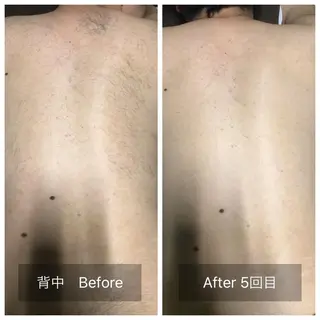 メンズ マンモス脱毛 札幌白石店のその他イメージ