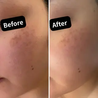 肌質改善｜エステ Connect ゆいのエステ・リラクイメージ