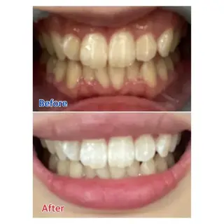 M渋谷店所属・M渋谷 ホワイトニングのエステ・リラクイメージ