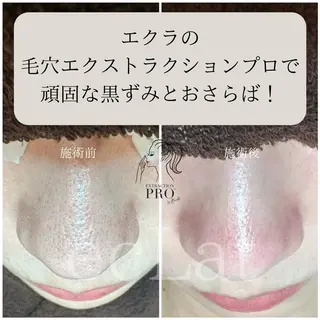 岩本 麻那のマツエク・マツパデザイン