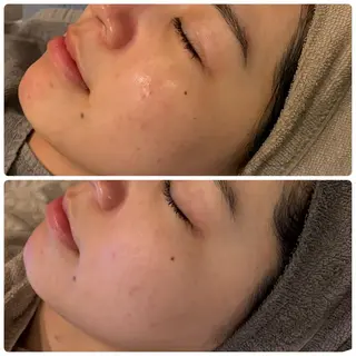 yellow.所属・yellow💛【 脱毛&フェイシャル】のエステ・リラクイメージ