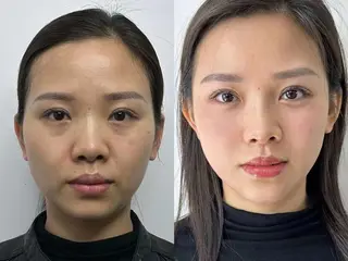 ネイル aliaハイフ&水光ジェットサロン所属・aliaハーブ水光店 エステティシャン募集のエステ・リラクイメージ