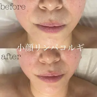 メンズ フェイシャルサロン CHIARA 荒田のエステ・リラクイメージ