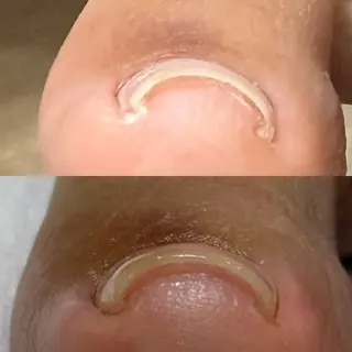 ネイル nail salon -TOIRO-所属・-TOIRO- Eriのネイルデザイン