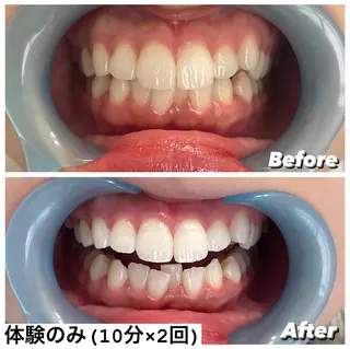 ホワイトニング専門店 Hi-Whiteのその他イメージ