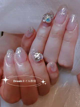 ネイル フィルイン、長さ出し 深爪矯正のネイルデザイン