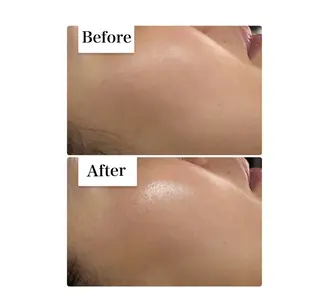 ROR Akariのエステ・リラクイメージ