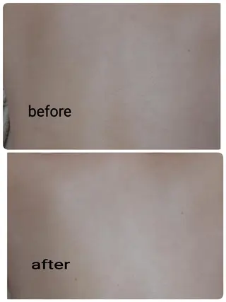 肌ケア＆毛穴洗浄 Cheriのエステ・リラクイメージ