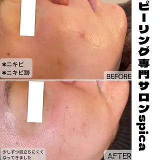 ピーリング専門サロン Spicaのエステ・リラクイメージ