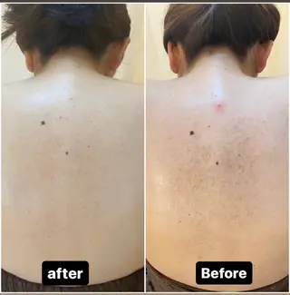 BELCIA福岡店　récolte de BELCIA（レコルトデベルシア）所属・BELCIA福岡店 レコルトデベルシアのエステ・リラクイメージ