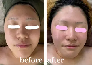 肌質改善✨ Nanala　Яのエステ・リラクイメージ