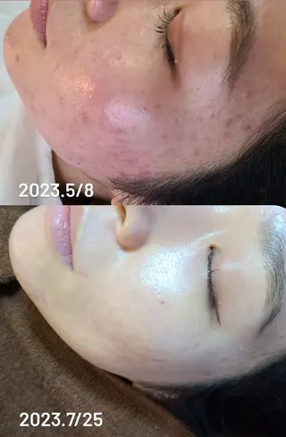 Premier 所属・寺西 さくらのエステ・リラクイメージ