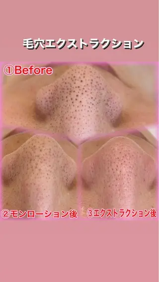 Ummi所属・肌管理／眉毛．まつ毛 陽子の眉毛・アイブロウイメージ