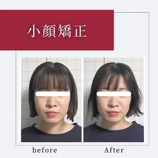 小顔矯正専門店 【RED】池田のエステ・リラクイメージ