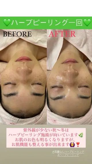 メンズ Salon de Lino 御器所のエステ・リラクイメージ