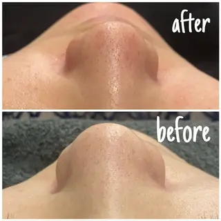 アルカンジュ~archange~所属・痩身/毛穴洗浄/脱毛 アルカンジュのエステ・リラクイメージ