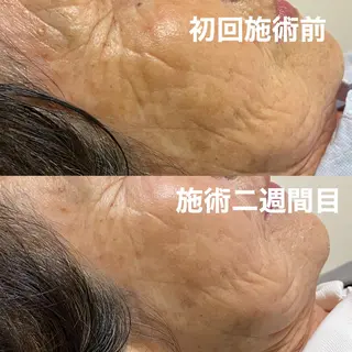 鍼灸整体院　蕾所属・美容鍼 蕾【谷町六丁目】のエステ・リラクイメージ