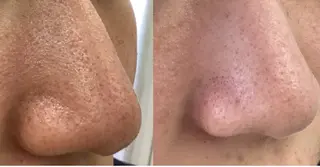 美肌専門サロン RUBONのエステ・リラクイメージ