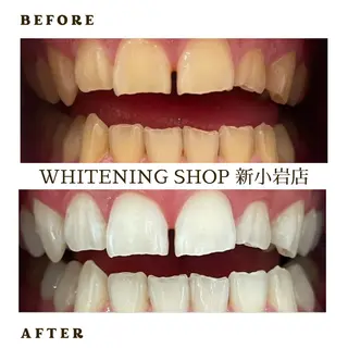 メンズ ホワイトニング ショップ新小岩店のその他イメージ