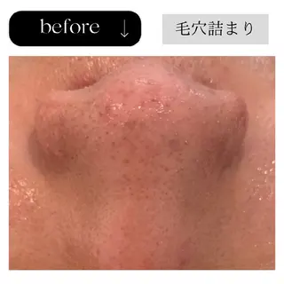 ICHOOSE/ 代々木上原のエステ・リラクイメージ