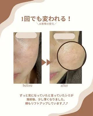 プライベートサロン COVOのエステ・リラクイメージ