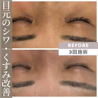 小顔矯正専門店 【RED】池田のエステ・リラクイメージ